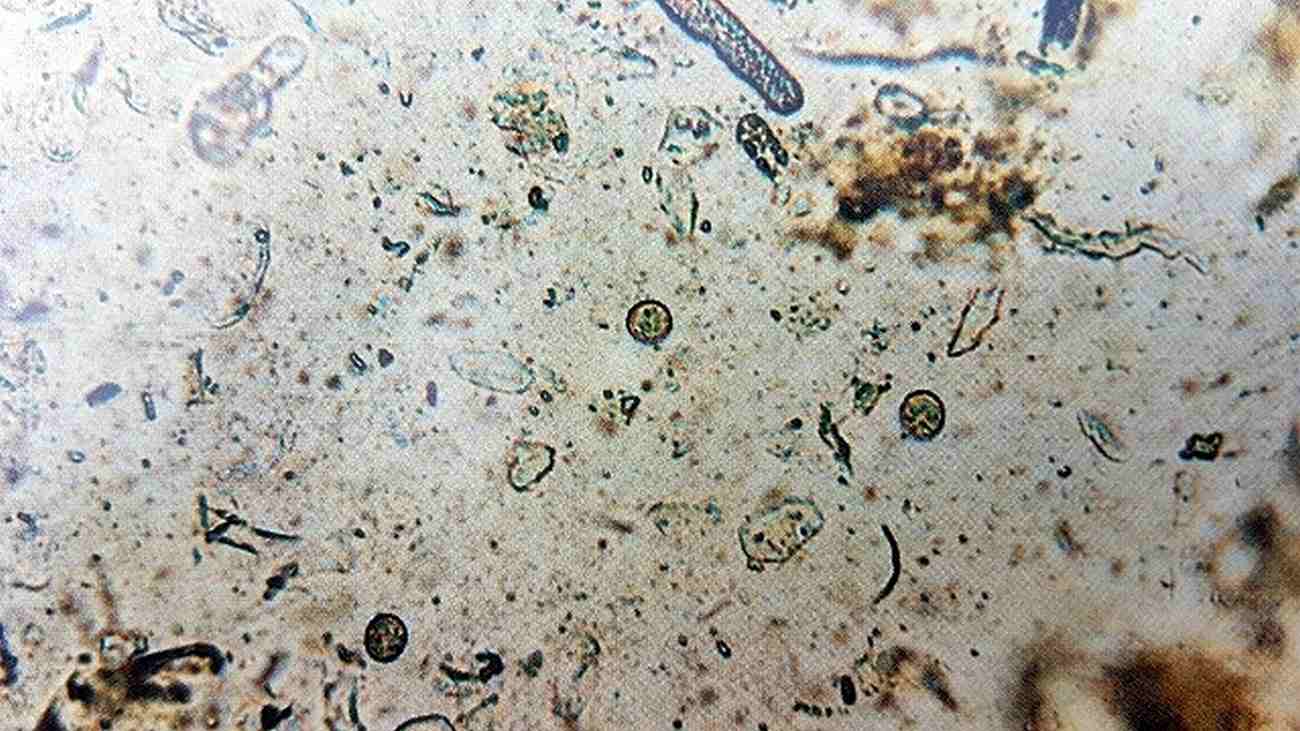 آلودگی‌های انگلی در پرندگان زینتی